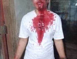 Dipicu Cemburu Buta, IRT di Dusun Serdang Dibacok Sang Mantan Suami