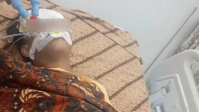 Polisi Tetapkan 5 Bocah SD Sebagai ABH Kasus Bullying di SDN Toboali